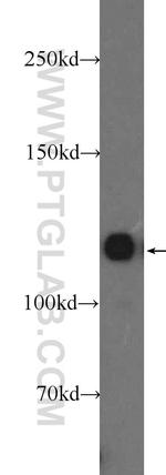 KRI1 Antibody in Western Blot (WB)