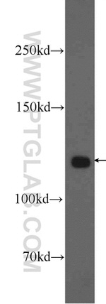 KRI1 Antibody in Western Blot (WB)