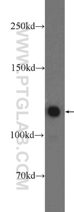 KRI1 Antibody in Western Blot (WB)