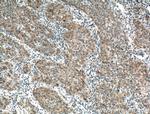 TBRG4 Antibody in Immunohistochemistry (Paraffin) (IHC (P))