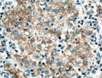 TBRG4 Antibody in Immunohistochemistry (Paraffin) (IHC (P))