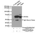 TBRG4 Antibody in Immunoprecipitation (IP)