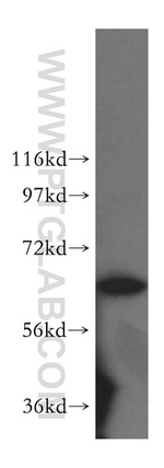 TBRG4 Antibody in Western Blot (WB)