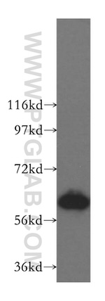 TBRG4 Antibody in Western Blot (WB)