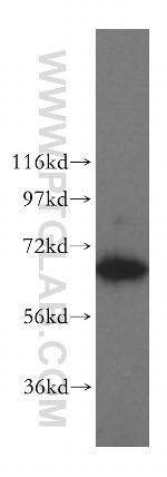 TBRG4 Antibody in Western Blot (WB)