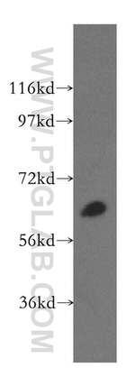 TBRG4 Antibody in Western Blot (WB)