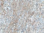SAT2 Antibody in Immunohistochemistry (Paraffin) (IHC (P))
