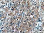 SAT2 Antibody in Immunohistochemistry (Paraffin) (IHC (P))