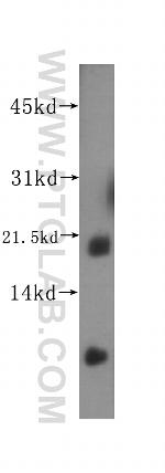 SAT2 Antibody in Western Blot (WB)