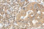 PSF2 Antibody in Immunohistochemistry (Paraffin) (IHC (P))