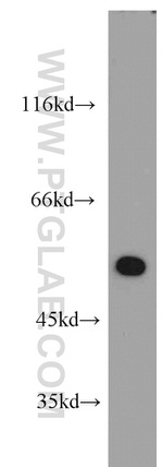 FAF2 Antibody in Western Blot (WB)