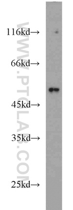 FAF2 Antibody in Western Blot (WB)