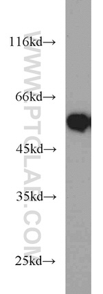FAF2 Antibody in Western Blot (WB)