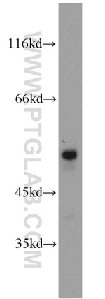 FAF2 Antibody in Western Blot (WB)