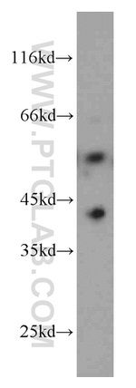 FAF2 Antibody in Western Blot (WB)