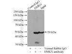 DMKN Antibody in Immunoprecipitation (IP)