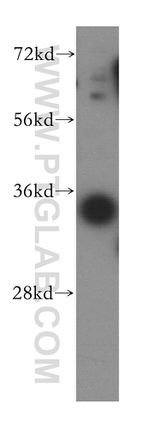 MRPL1 Antibody in Western Blot (WB)