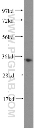 MRPL1 Antibody in Western Blot (WB)