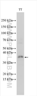 CHMP4C Antibody in Western Blot (WB)