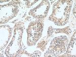 RGS14 Antibody in Immunohistochemistry (Paraffin) (IHC (P))