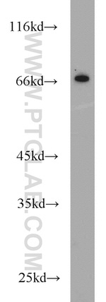 RGS14 Antibody in Western Blot (WB)