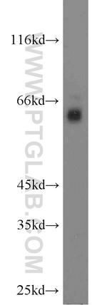 RGS14 Antibody in Western Blot (WB)