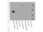 RGS14 Antibody in Western Blot (WB)