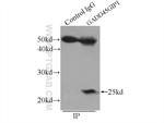 GADD45GIP1 Antibody in Immunoprecipitation (IP)