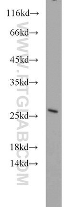 GADD45GIP1 Antibody in Western Blot (WB)