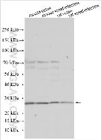 HTN3 Antibody in Western Blot (WB)