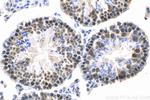 MED28 Antibody in Immunohistochemistry (Paraffin) (IHC (P))