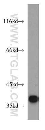 PQBP1 Antibody in Western Blot (WB)