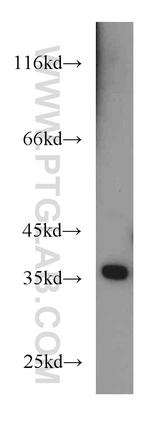 PQBP1 Antibody in Western Blot (WB)