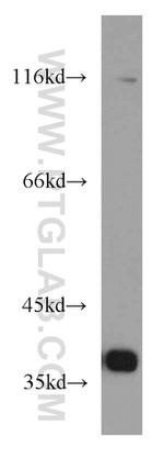 PQBP1 Antibody in Western Blot (WB)