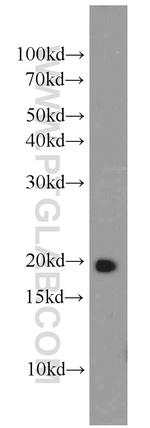 RAP2B Antibody in Western Blot (WB)