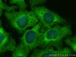 RPS17 Antibody in Immunocytochemistry (ICC/IF)