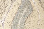 RPS17 Antibody in Immunohistochemistry (Paraffin) (IHC (P))
