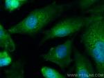 CEP63 Antibody in Immunocytochemistry (ICC/IF)