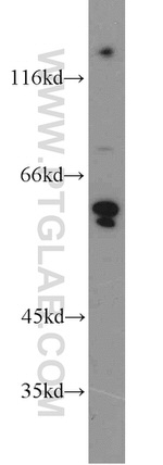 CEP63 Antibody in Western Blot (WB)
