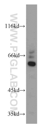 CEP63 Antibody in Western Blot (WB)