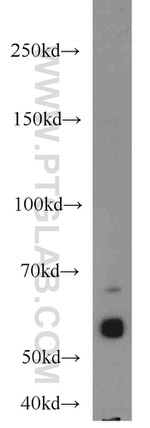 CEP63 Antibody in Western Blot (WB)