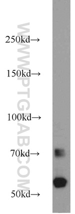 CEP63 Antibody in Western Blot (WB)