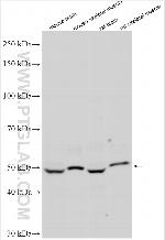 PPM1J Antibody in Western Blot (WB)