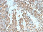 Drebrin 1 (DBN1) Monoclonal Antibody (DBN1/3393)