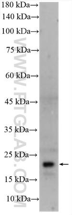 PPCDC Antibody in Western Blot (WB)