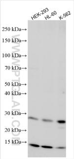 PPCDC Antibody in Western Blot (WB)