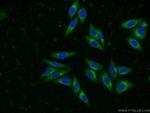 SYAP1 Antibody in Immunocytochemistry (ICC/IF)