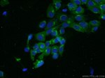 SYAP1 Antibody in Immunocytochemistry (ICC/IF)