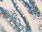SYAP1 Antibody in Immunohistochemistry (Paraffin) (IHC (P))
