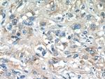 SYAP1 Antibody in Immunohistochemistry (Paraffin) (IHC (P))